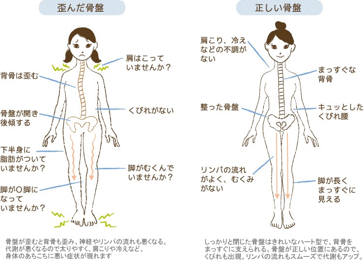 骨盤の歪み